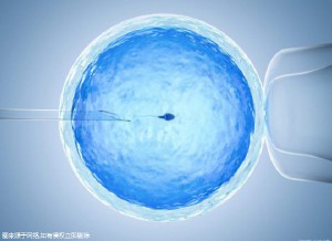 无精症成功案例